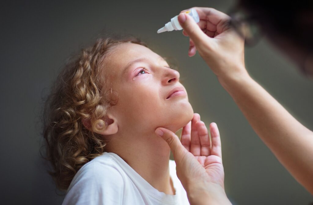 Curly haired child getting eyedrops instilled in inflamed eye by adult hands.