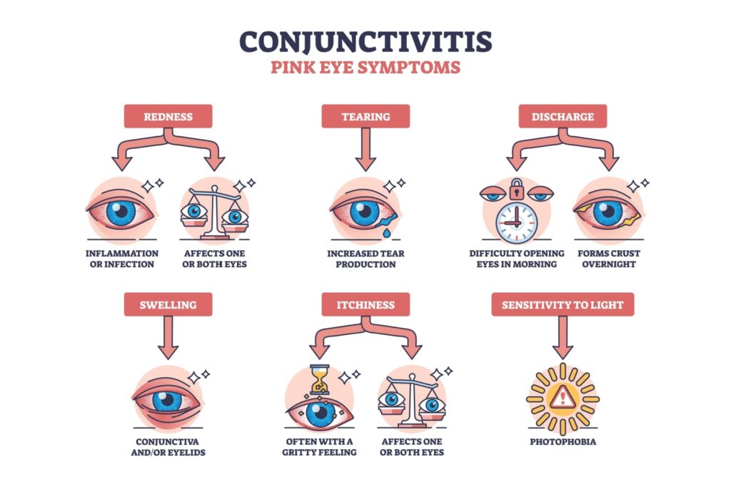 Infographic showing common conjunctivitis (pink eye) symptoms including redness, tearing, discharge, swelling, itchiness, and light sensitivity with illustrated eyes and icons.